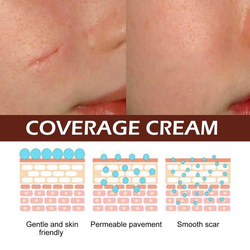 Ouhoe Scar Repair Cream For Effective Skin Scar Reduction And Healing Solutions