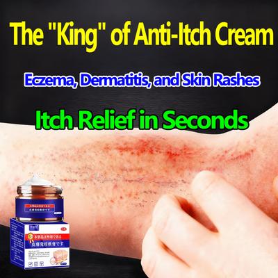 Anti-Itch Cream 50g Large Size, Fast Relief for Eczema, Fungal, Dermatitis & Skin Rashes, Antiseptic