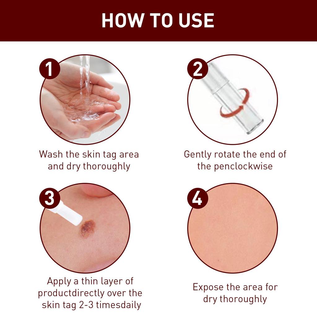 Tags & Moles Remover, WipeOff Tags & Moles Remover, WipeOff Remover 3ML
