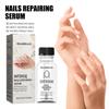 Nail Repair Essence Skystas rankų ir pėdų pilkas nagas Minkštas nagas pageltonantis, blizgantis nagų valymas.