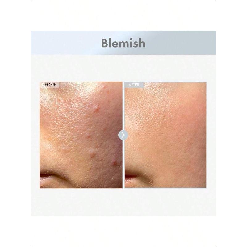 Tosowoong Niacinamid 15% Pleťové sérum 30ml | Vysoká účinnost 150 100 ppm Niacinamid & Kyselina tranexamová Směs, Složení pro korekci tmavých skvrn