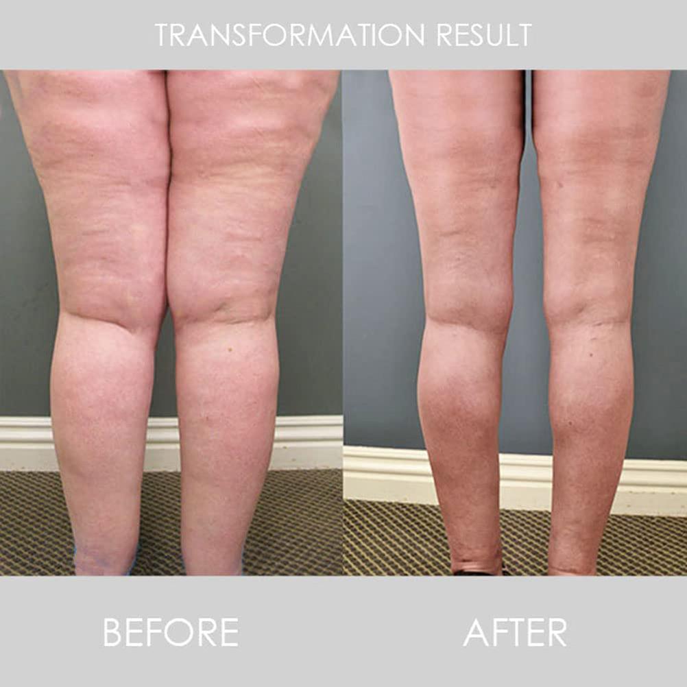 2 Pack Lymphatic Drainage Magnetic Ring Adjustable Opening Ring Weight Loss Slimming Magnetic Ring for Men Women