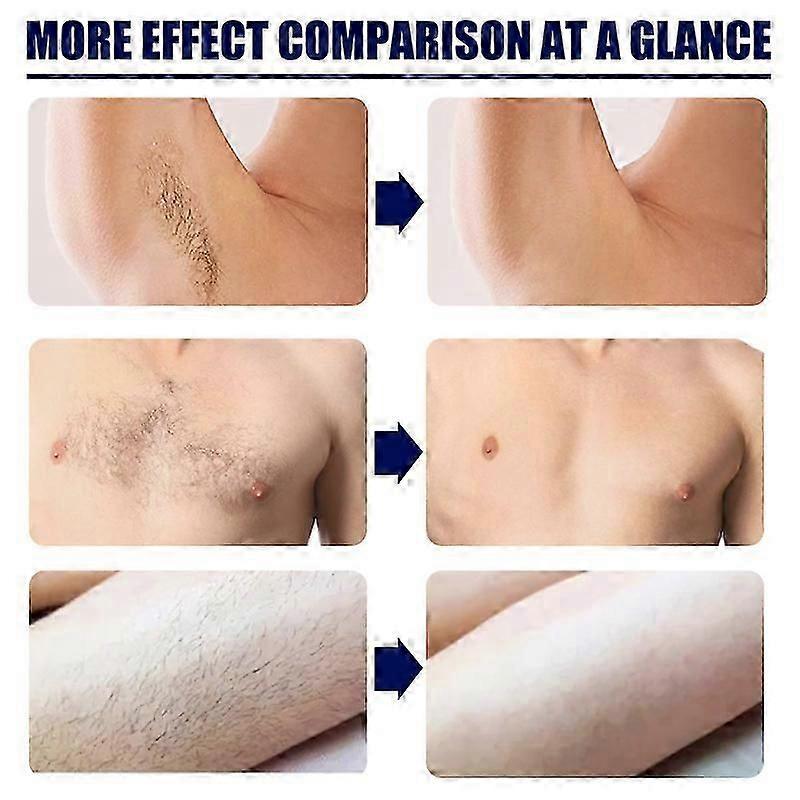 Beard Hair Removal Cream for Men Painless Soothing Depilatory Cream Effective Hair Removal Cream for Most Skin Types
