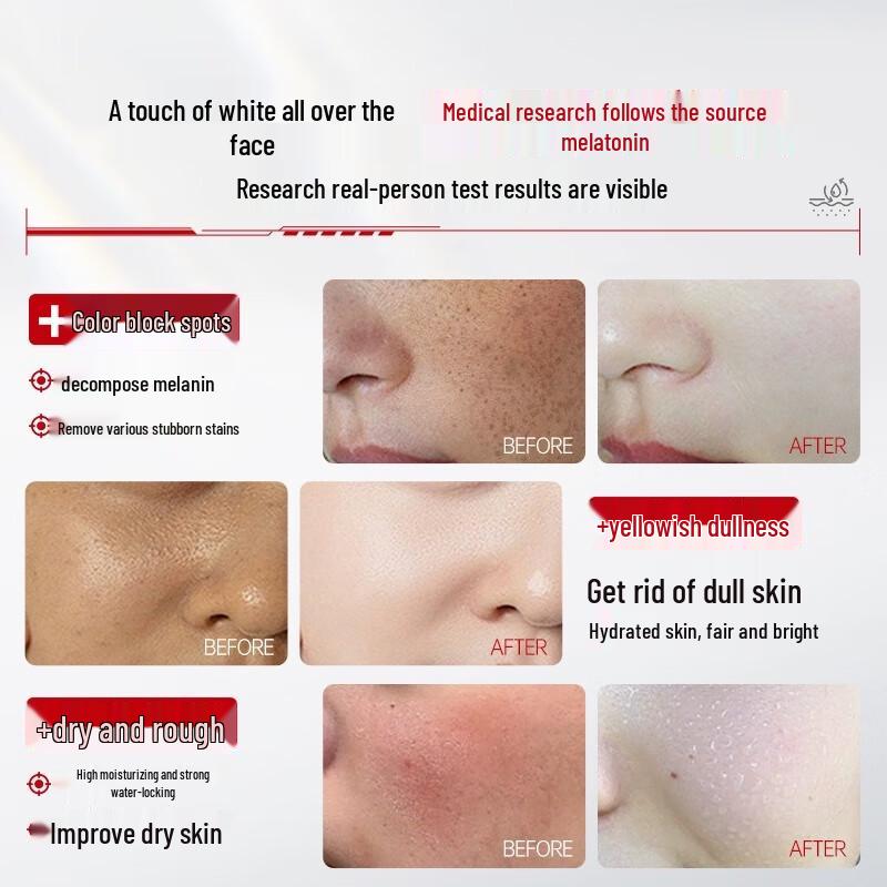 BAILUHUI 577 Niacinamide Brightening Spot Cream