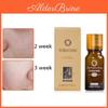 Dark Skin Spot Corrector Care Fade Essence Oil Lightening Blemish Removal Serum