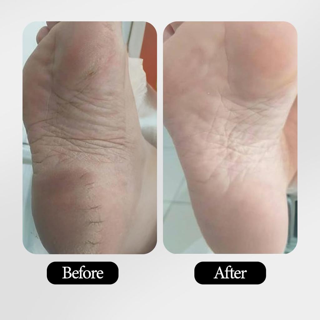 Mitchell USA Anti-aging Foot Cream with Intensive Deep Nourish | Softens and Repairs Dry & Rough Feet | With Lotus Seed Extracts & Shea Butter |