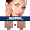 Scar Repair Cream Fade Post-scald Scar Moisturizing Repair Remove Cellulite Scar Cream