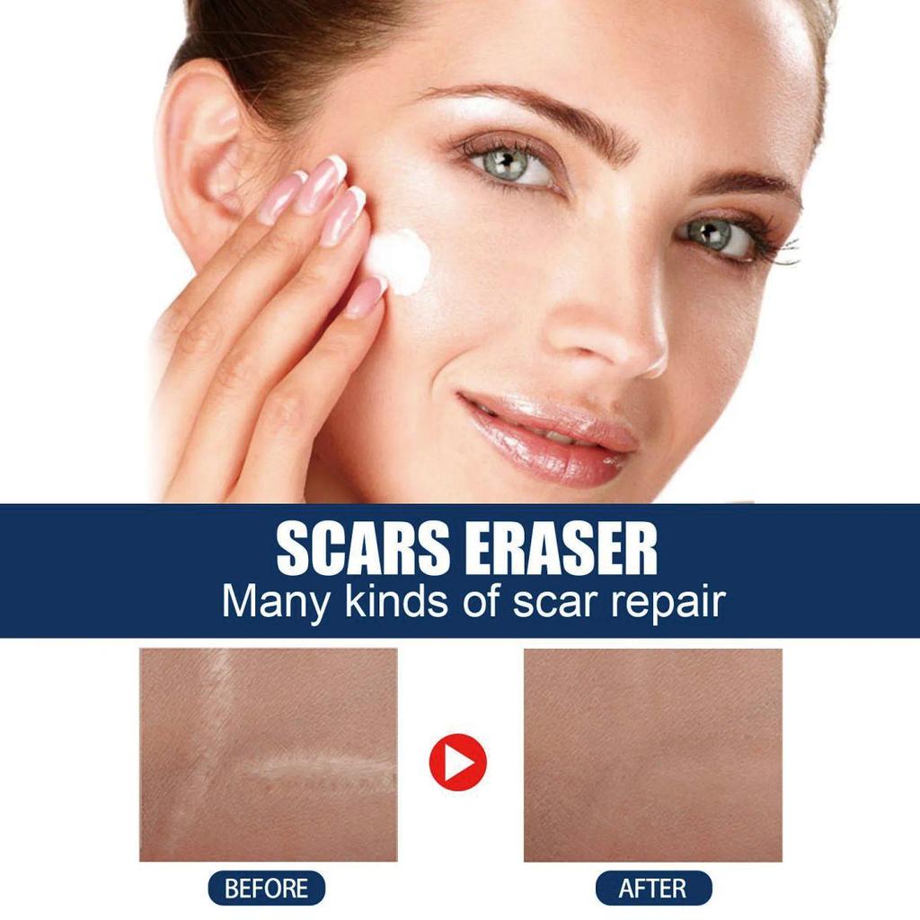 Scar Repair Cream Fade Post-scald Scar Moisturizing Repair Remove Cellulite Scar Cream