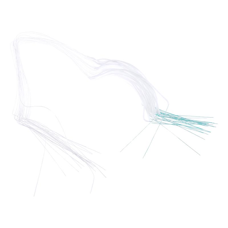 50 ks Nástroj na párátka Navlékače zubní nitě Držáky zubní nitě Mezi ortodontickými rovnátky Most Hilo Zubní Ústní Čištění