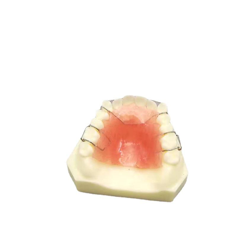 Maxillary Partial Denture Demonstration Model - White Tooth for Doctor-Patient Communication (Free Shipping)