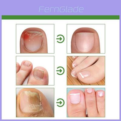 Manicure – Cuidado das unhas