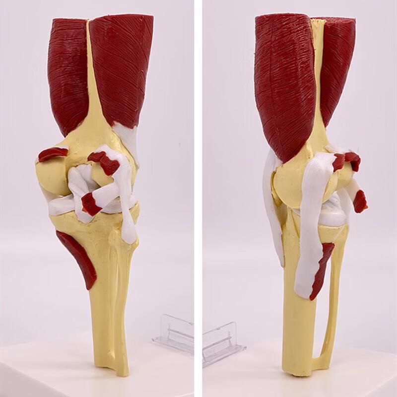 Blue Butterfly Human Knee Joint Anatomical Model with Muscles