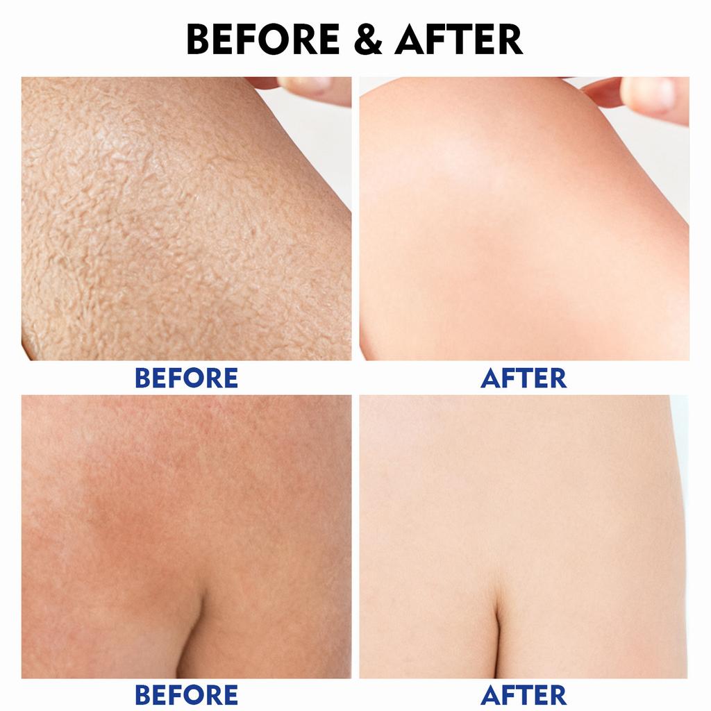 Kiss Beauty Hyaluronic Acid Body Lotion Moisturizing Moisturizing Long Lasting Emollient 400ml