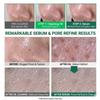 UNGBOON EDITOR Green Tomato Pore Cleansing Oil + Green Tomato NMN Pore Lifting Ampoule K-Beauty Blackhead Remover & Pore Tightening Set 200ml + 40ml