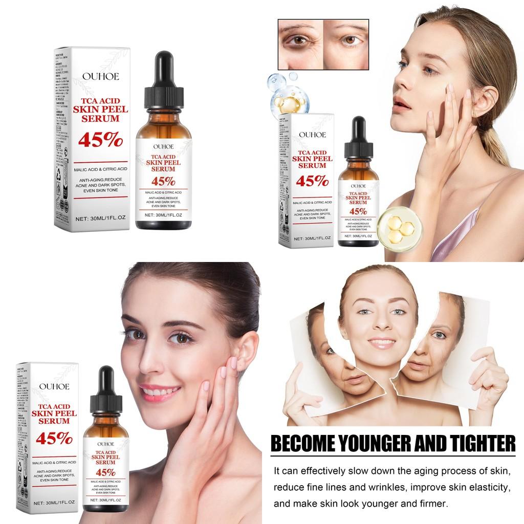 Ouhoe Anti-wrinkle Essence Hydrating Formula For Firm And Youthful Skin 30ml