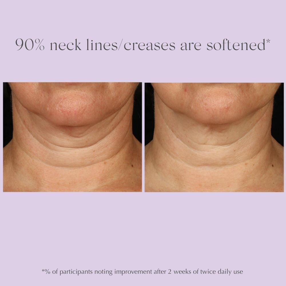 Exuviance Age Reverse+ Toning Neck Cream