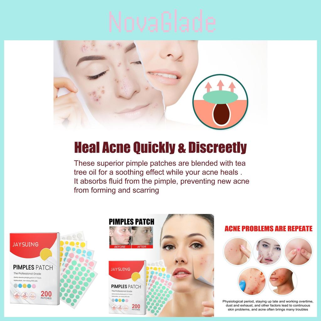 Jaysuing Colorful Acne Patches For Effective Spot Treatment And Scar Reduction 200pcs