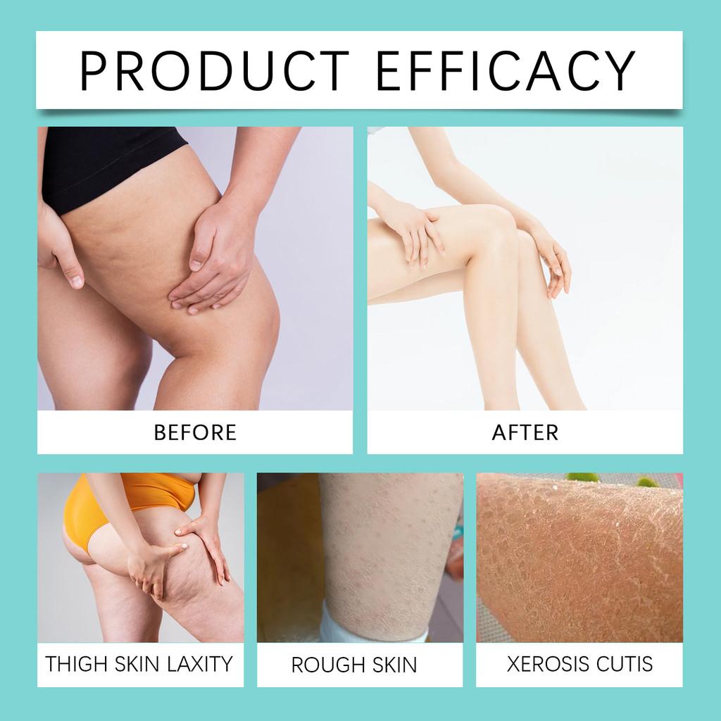 Eelhoe Leichte, nicht fettende Beinpflegecreme für tägliche Pflege und Feuchtigkeitspflege