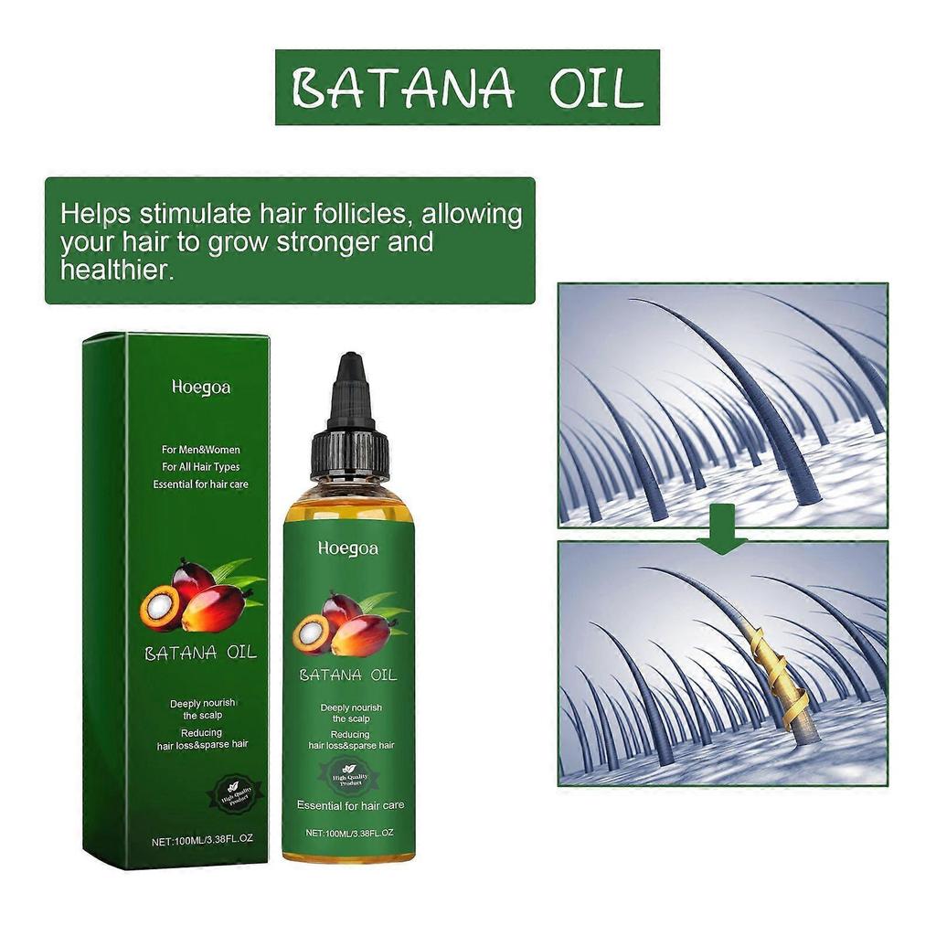 2025 Latest Model  Oil, Hair Repair Strong And Firm Hair, Anti-Loss And Dense