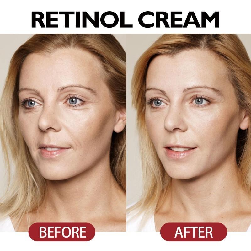 West Month Retinol Firming Cream For Youthful Skin Moisturizing Anti-aging Benefits
