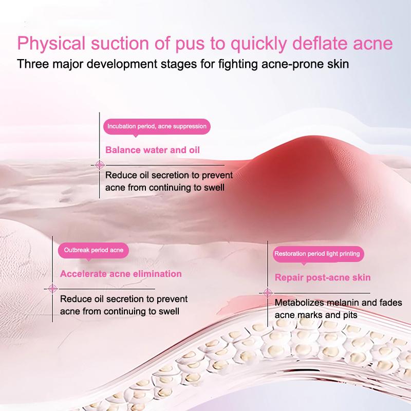 360Pcs Colorful Invisible Pimple Removal Anti-Acne Hydrocolloid Patches Spots Marks Concealer Beauty Makeup Tool Repair Sticker