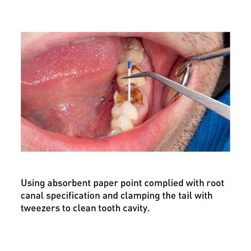 1 Box Dental Absorbent Paper Points Gp/Pp 02 Taper 15-80# Dentist Use Dentistry Materials Endodontic Cotton Fiber Tips