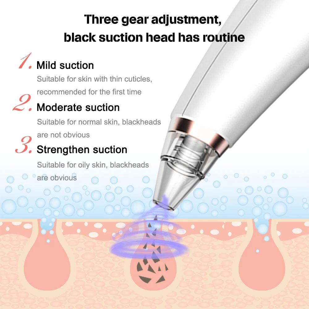 Beauty Instrument 6 Nozzle Facial Vacuum Pore Cleaner. Instrument for cleaning pores and blackheads. Instrument for facial cleansing and exfoliation