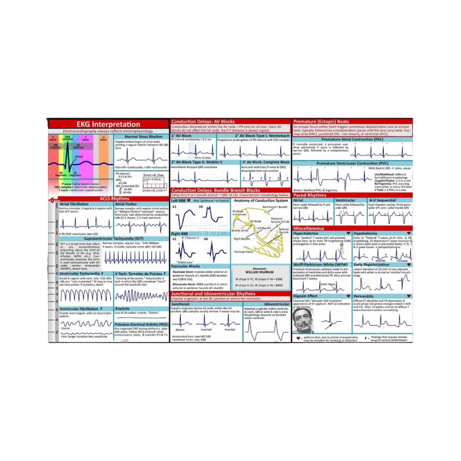 

Карманный справочник по электрокардиограмме, карты интерпретации электрокардиограммы, держите вас в курсе состояния вашего сердца One Size