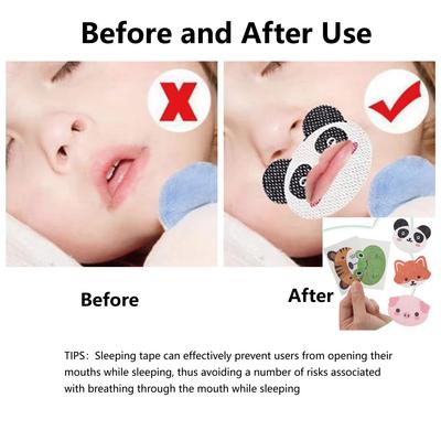 Accesorios, productos para dormir y anti ronquidos – Sueño y ronquido