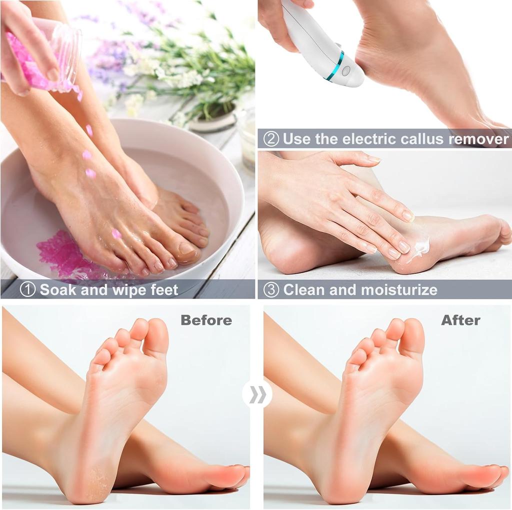 Callus Remover, Foot File Rechargeable 2 Speed, Professional Foot Scrubber with 3 Coarse Roller Heads,