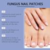 Ruce a nohy Měkké nehty Inkrustované nehty Zesilující Zářivé nehty Rýhované Šedé nehty Péče Náplast, 50 ks