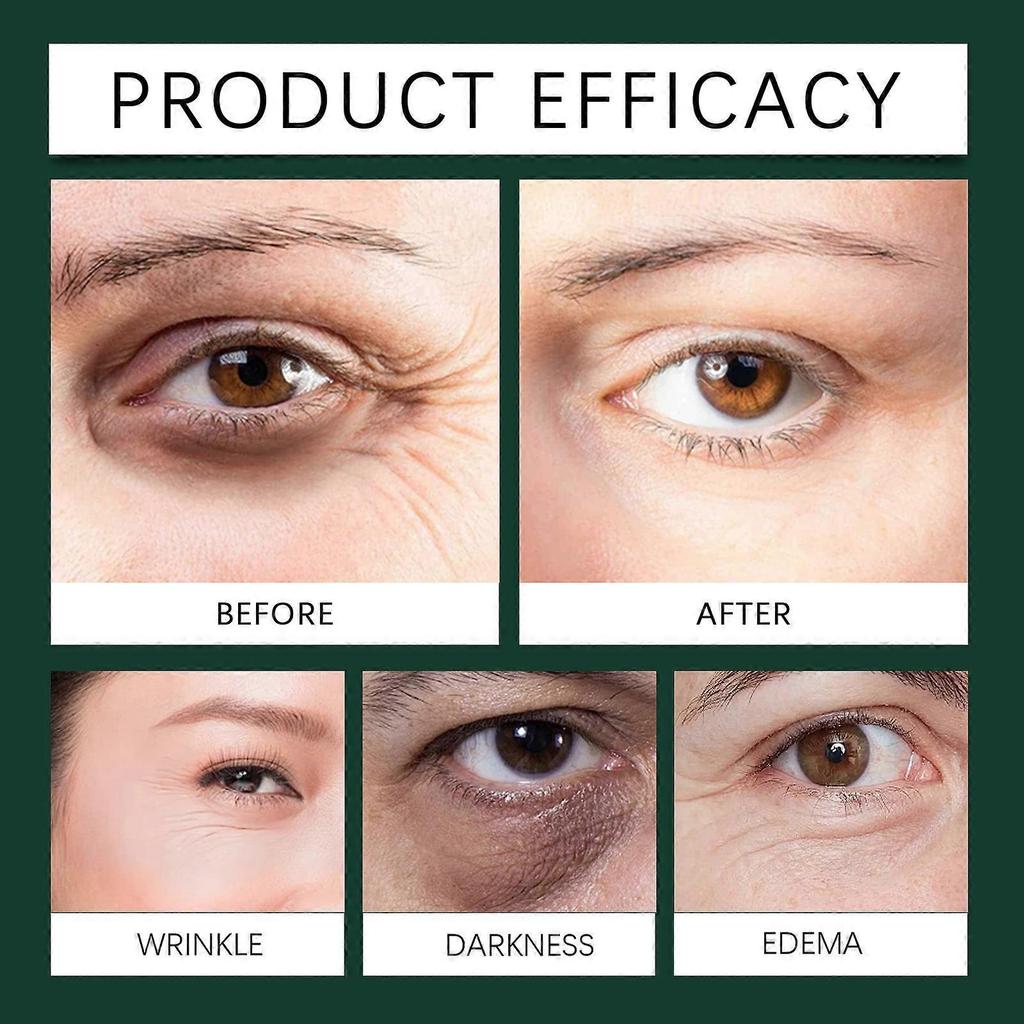 Mint Eye Repair Essence, Mint Ball Eye Care Essence, Fade Fine Lines Crow's Feet, Eye Moisturizing and Anti-wrinkle Essence