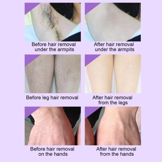 10Pcs Hair Removal Wax Strips Painless Beginner Friendly Disposable Men Women Body Facial Armpit Leg Bikini Hair Removal Wax Paper