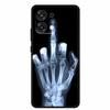 Per Oppo A6 Pro 4G 5G Custodia Versione Globale 2025 Lusso Morbido Silicone Cover Posteriore Per Oppo A6 Pro TPU 6.57" Protezione Paraurti Coque