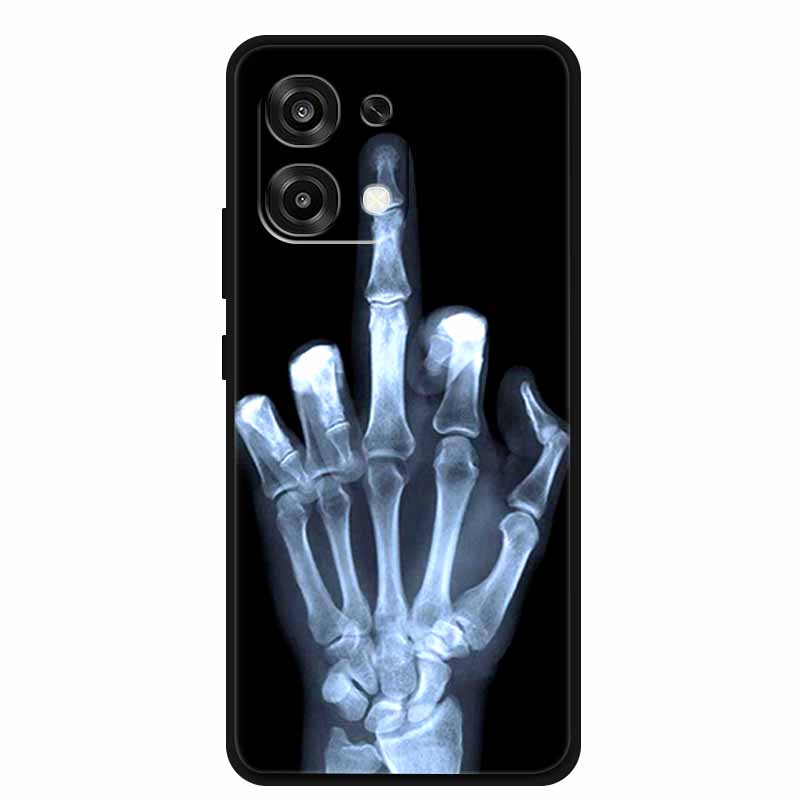 Per Oppo A6 Pro 4G 5G Custodia Versione Globale 2025 Lusso Morbido Silicone Cover Posteriore Per Oppo A6 Pro TPU 6.57" Protezione Paraurti Coque