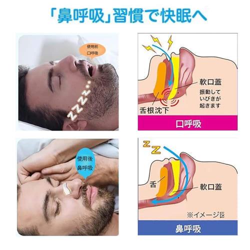Anti-Snoring Aid, Nasal Cavity Expander, Mouth Breathing Prevention Tape, Magnetic Nose Clip, Magnetic Nose Band, Nasal Breathing, Improves Nasal Cong