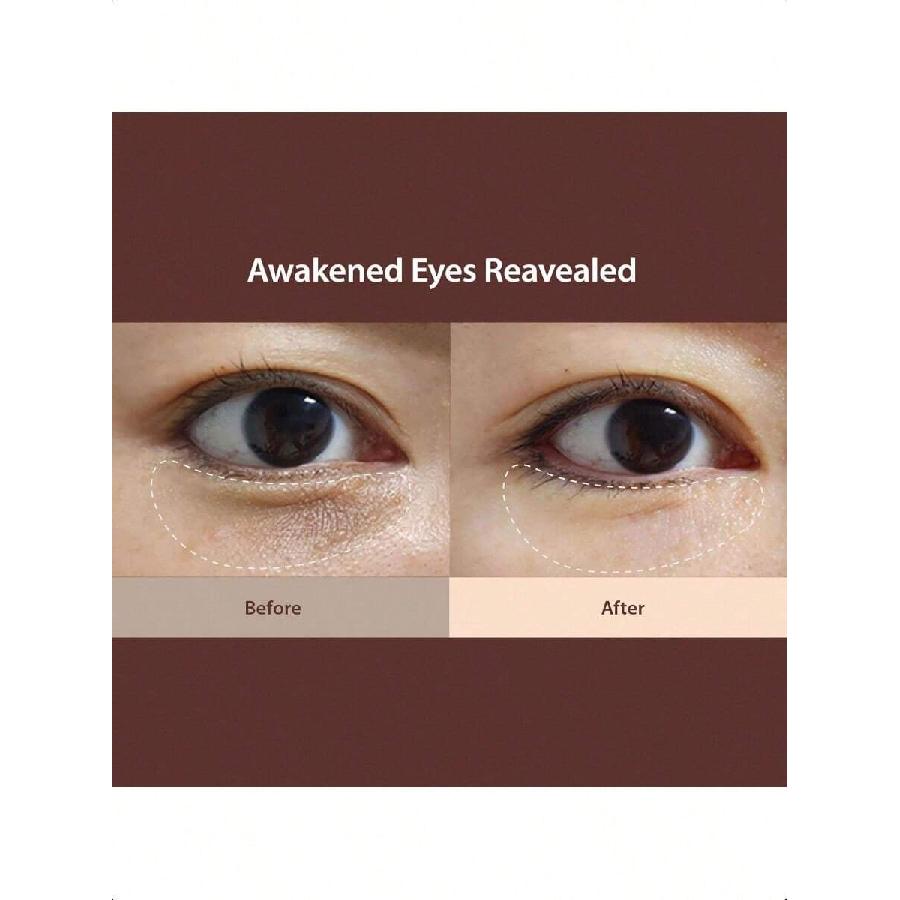 Blithe Caffeine Eye Serum For Dark Circles And Puffiness 20ml , Plant-Based Retinol, Bakuchiol, Niacinamide, Sodium Ascorbyl Phosphate