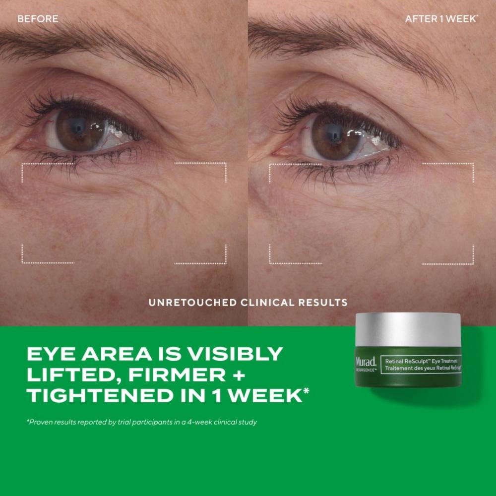 Murad Retinal Resculpt Advanced Eye Lift Treatment 0.5 Oz