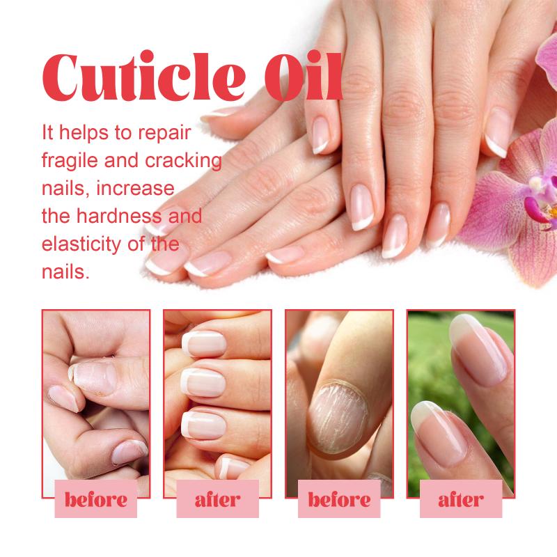 Nourishing Cuticle Oil Pen for Damaged Nails Infused with Fruit Scents Repairs and Strengthens Brittle Cuticles Home Manicure