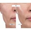 kopher Feuchtigkeitsspendende Barriere Strahlende Elastizität Melder SOS System 1,5 ml*20 Stück(30ml)