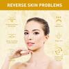 Rynkborttagare Ansiktsserum Lyftande Anti-aging Reducera Fina Linjer Återfuktande Essens