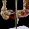 Human Colorectal Lesion Model Pathological Anatomy Colon Diseases Intestine Medical Teaching Learning Tool