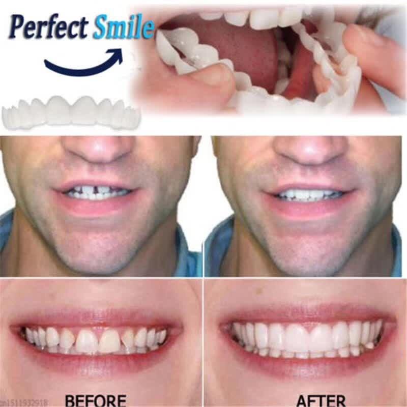 Instant Comfort Smile Cosmetic Teeth Denture Teeth Top Veneer Cosmetic