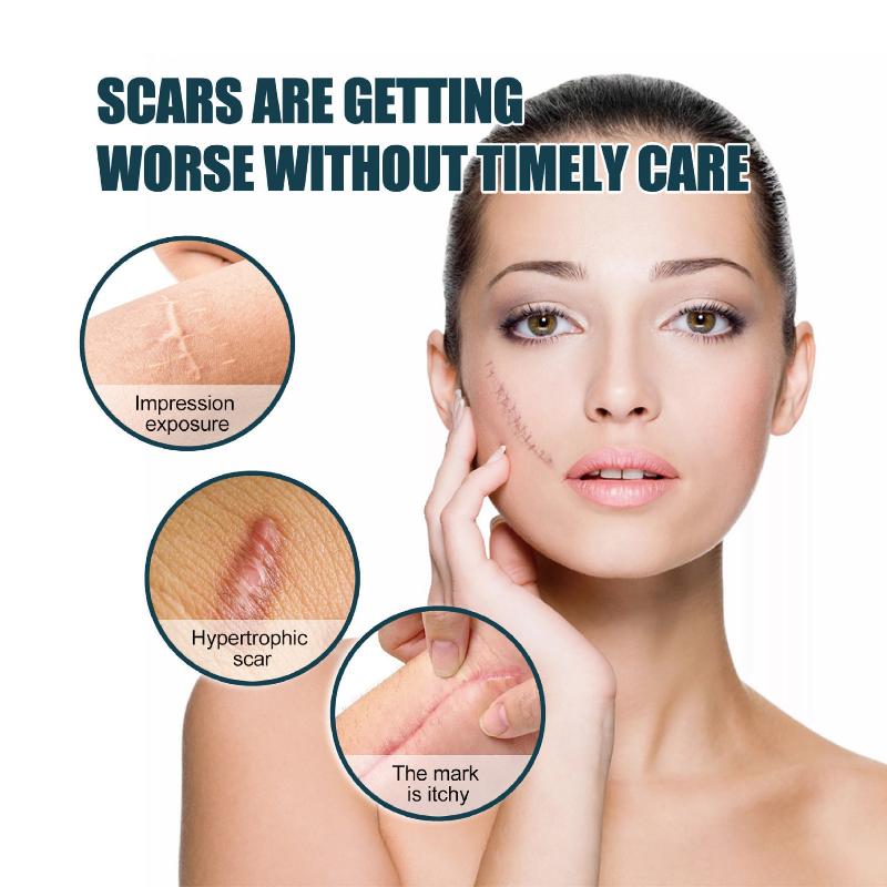 1 Roll Silicone Gel Scar Sheet Patch Treatment Removal Tape Cover Burn Trauma Repair Acne Ear Scar Section Beauty Skin