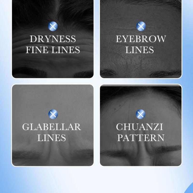 Hyaluronic Acid Forehead Sticker SADOER Collagen Firming Improves Forehead Lines