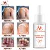 Herbal Nail Treatment Essential Oil Hand and Foot Whitening Toe Nail Removal Feet Care Polish Nail Gel Nail Repair Treatment