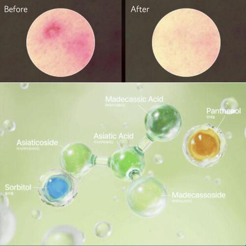 Anua Heartleaf Centella Red Spot Cream 30g