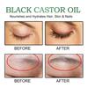 Eelhoe Castor Oil Hair Growth Serum Rich Nourishing Scalp Massage Treatment 60ml Set