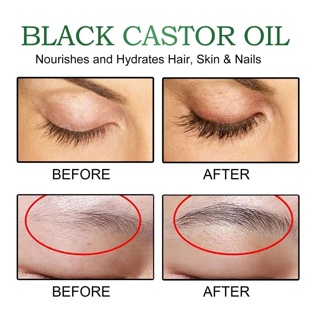 Eelhoe Castor Oil Hair Growth Serum Rich Nourishing Scalp Massage Treatment 60ml Set