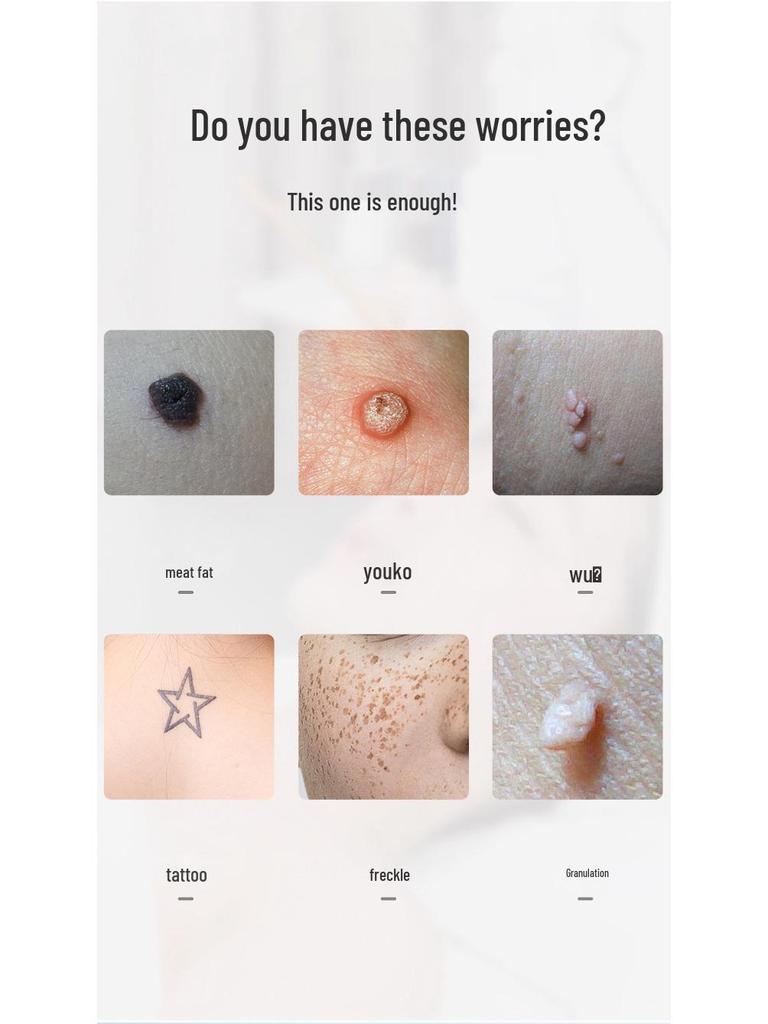 Ultra Picosecond Freckle & Mole Laser Removal Machine: Portable All-in-One Home & Salon Use